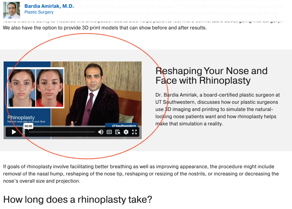Rhinoplasty: What to Expect Before and After - video